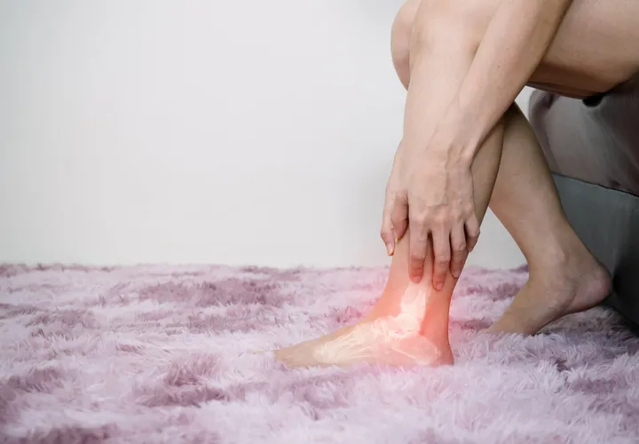 Plantar Fasciitis